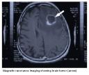 brainmri.jpg