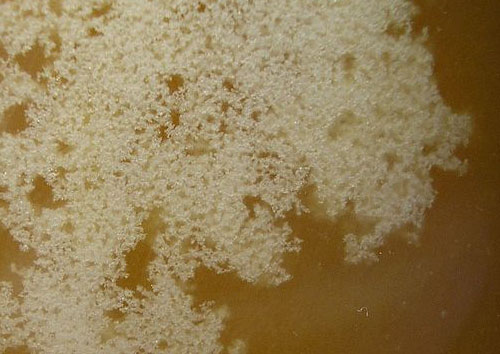 800px-Crystallized_honey